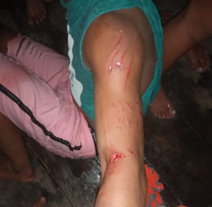 Jovem é atacado por jacaré enquanto tomava banho em rio no interior do Amazonas
